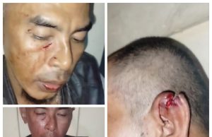 Tragedi Subang Terhadap Jurnalis Jadi Sejarah Kelam,Untuk Para Jurnalis. Ramai Tag Subang Zona Merah