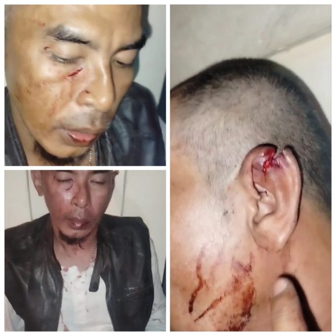 Tragedi Subang Terhadap Jurnalis Jadi Sejarah Kelam,Untuk Para Jurnalis. Ramai Tag Subang Zona Merah